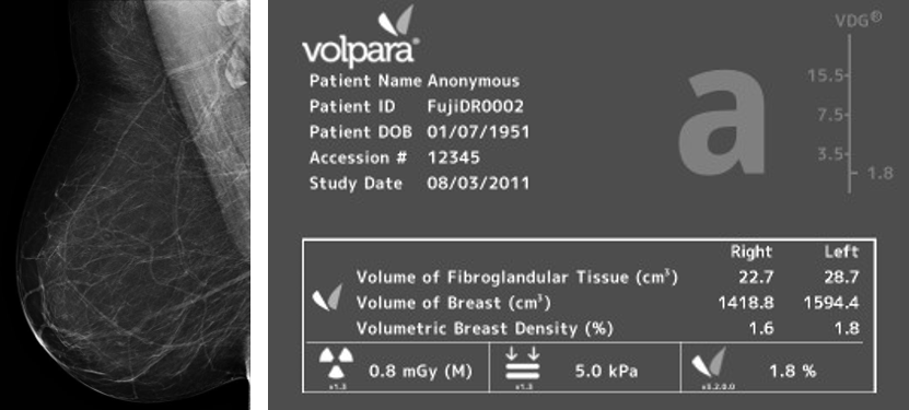 Volpera Density Scale-1