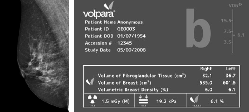 Volpera Density Scale-2