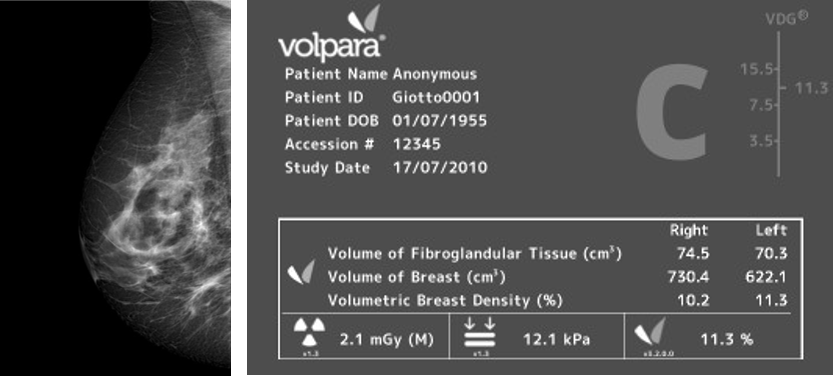 Volpera Density Scale-3