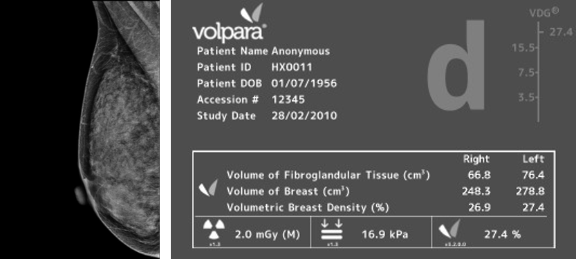 Volpera Density Scale-4